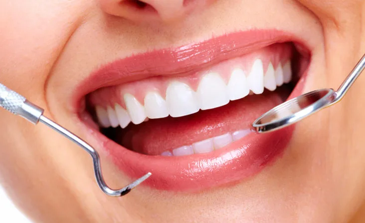 Professional Teeth Whitening